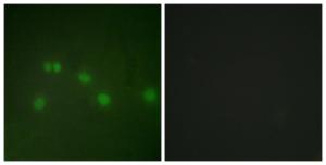 Immunofluorescence analysis of HUVEC cells using Anti-COT2 Antibody The right hand panel represents a negative control, where the antibody was pre-incubated with the immunising peptide