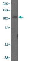 Anti-UNC13D Goat Polyclonal Antibody