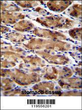 Anti-ATG16L2 Rabbit Polyclonal Antibody