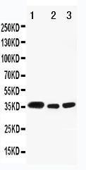 Anti-HSD17B1 Rabbit Polyclonal Antibody