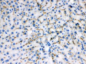 Anti-ABCB11 Rabbit Polyclonal Antibody