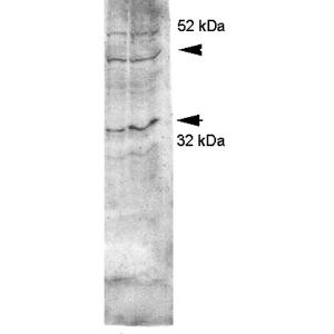 Antibody A304990-100 100 µg