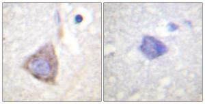 Immunohistochemical analysis of paraffin-embedded human brain tissue using Anti-Bcr Antibody. The right hand panel represents a negative control, where the antibody was pre-incubated with the immunising peptide