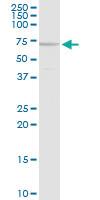 Anti-MEN1 Rabbit Polyclonal Antibody