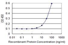 Anti-ENAH Mouse Monoclonal Antibody [clone: 3E6]