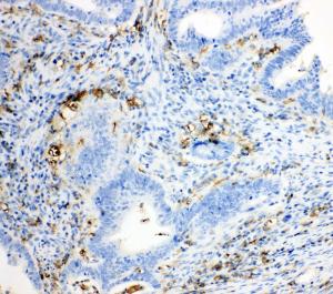 Anti-TRPC6 Rabbit Polyclonal Antibody