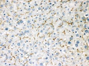 Anti-ABCB11 Rabbit Polyclonal Antibody