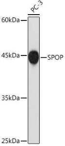 Anti-SPOP Rabbit Monoclonal Antibody [clone: ARC2181]