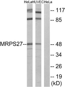 Western blot analysis of lysates from HeLa and HUVEC cells using Anti-MRPS27 Antibody. The right hand lane represents a negative control, where the antibody is blocked by the immunising peptide