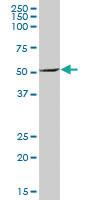 Anti-PSMD5 Mouse Polyclonal Antibody