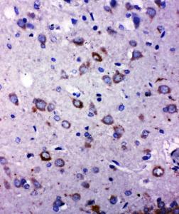 Anti-TRPC6 Rabbit Polyclonal Antibody