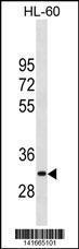 Anti-MMP26 Rabbit Polyclonal Antibody (PE (Phycoerythrin))