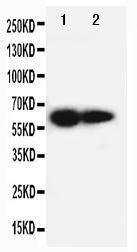 Anti-IL2 Receptor beta Rabbit Polyclonal Antibody