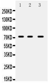 Anti-ABCG5 Rabbit Polyclonal Antibody