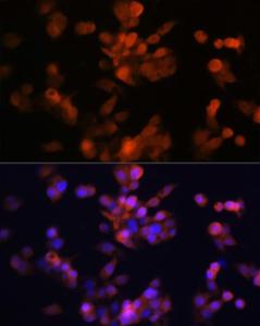 Immunofluorescence analysis of Hep G2 cells using Anti-LXR alpha Antibody [ARC0877] (A307802) at a dilution of 1:100 (40x lens). DAPI was used to stain the cell nuclei (blue).