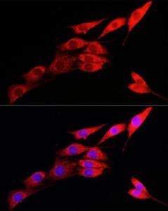 Immunofluorescence analysis of NIH/3T3 cells using Anti-IRE1 Antibody (A92812) at a dilution of 1:100 (40x lens) DAPI was used to stain the cell nuclei (blue)