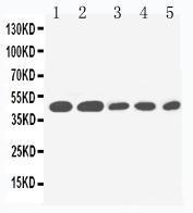 Anti-IL2 Receptor gamma Rabbit Polyclonal Antibody