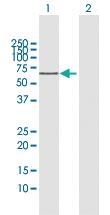 Anti-MEN1 Rabbit Polyclonal Antibody