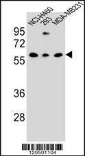 Anti-CLEC17A Rabbit Polyclonal Antibody (AP (Alkaline Phosphatase))