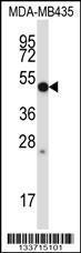 Anti-MMP28 Rabbit Polyclonal Antibody (AP (Alkaline Phosphatase))