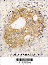 Anti-CDH3 Rabbit Polyclonal Antibody (FITC (Fluorescein Isothiocyanate))