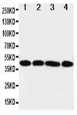 Anti-IL3RA Rabbit Polyclonal Antibody