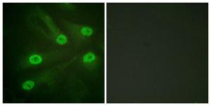 Immunofluorescence analysis of HeLa cells using Anti-p53 (acetyl Lys386) Antibody. The right hand panel represents a negative control, where the antibody was pre-incubated with the immunising peptide