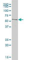 Anti-ACVR1B Mouse Polyclonal Antibody