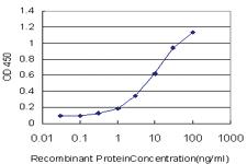 Anti-LRRK2 Mouse Monoclonal Antibody [clone: 3B2]