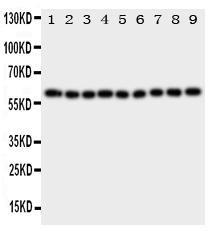 Anti-IL5RA Rabbit Polyclonal Antibody