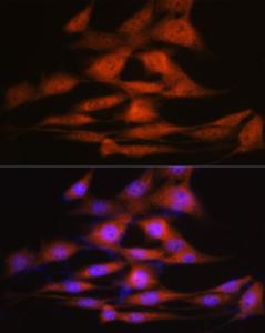 Immunofluorescence analysis of NIH-3T3 cells using Anti-LXR alpha Antibody [ARC0877] (A307802) at a dilution of 1:100 (40x lens). DAPI was used to stain the cell nuclei (blue).