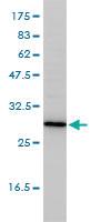 Anti-TPMT Mouse Monoclonal Antibody [clone: 1B5]