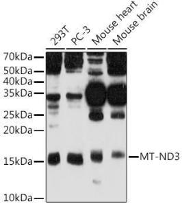 Western blot analysis of extracts of various cell lines, using Anti-MT-ND3 Antibody (A92816) at 1:500 dilution. The secondary antibody was Goat Anti-Rabbit IgG H&L Antibody (HRP) at 1:10,000 dilution.