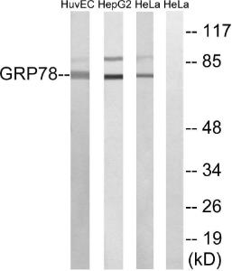 Antibody anti-GRP78 100 µg