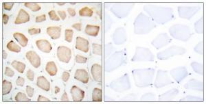 Immunohistochemical analysis of paraffin-embedded human skeletal muscle tissue using Anti-CHOP Antibody. The right hand panel represents a negative control, where the Antibody was pre-incubated with the immunising peptide