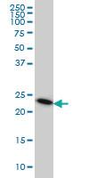 Anti-TRAPPC4 Mouse Monoclonal Antibody [clone: 2D10]