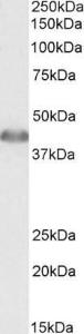 Anti-ACAT1 Antibody (A84739) (001 µg/ml) staining of Human Liver lysate (35 µg protein in RIPA buffer) Primary incubation was 1 hour Detected by chemiluminescence