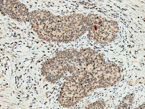 Immunohistochemistry analysis of human prostate, fixed in formalin and paraffin-embedded. The Primary Antibody used was Anti-HO-2 Antibody (A304991) at 1:50 for 30 minutes at room temperature. Counterstain: Hematoxylin. Magnification: 20X. HRP-DAB Detection