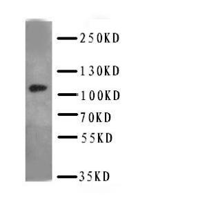 Anti-DPYD Rabbit Polyclonal Antibody