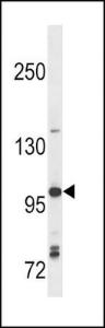 Anti-TLR7 Rabbit Polyclonal Antibody (AP (Alkaline Phosphatase))