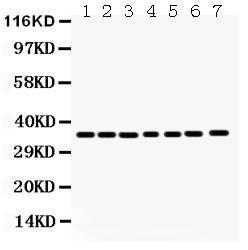 Anti-ANXA3 Rabbit Polyclonal Antibody