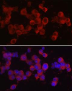 Anti-Ret antibody