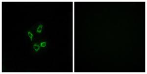 Immunofluorescence analysis of HUVEC cells using Anti-Cytochrome P450 4Z1 Antibody. The right hand panel represents a negative control, where the antibody was pre-incubated with the immunising peptide