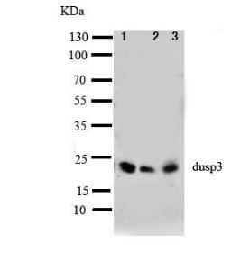 Anti-DUSP3 Rabbit Polyclonal Antibody