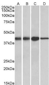 Anti-ACAT1 Antibody (A84739) (001 µg/ml) staining of Mouse (A) and Rat (B) kidney lysates, and Mouse (C) and Rat (D) Liver lysates (35 µg protein in RIPA buffer) Primary incubation was 1 hour Detected by chemiluminescence