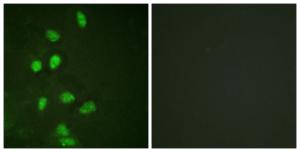 Immunofluorescence analysis of HeLa cells using Anti-CHOP Antibody. The right hand panel represents a negative control, where the Antibody was pre-incubated with the immunising peptide