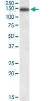 Anti-CILP Goat Polyclonal Antibody