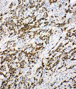 Anti-DCI Rabbit Polyclonal Antibody