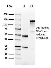 SDS-PAGE analysis of Anti-NKX3.1 Antibody [NKX3.1/3350] under non-reduced and reduced conditions; showing intact IgG and intact heavy and light chains, respectively. SDS-PAGE analysis confirms the integrity and purity of the Antibody