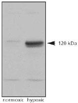 Anti-EPAS1 Rabbit Polyclonal Antibody